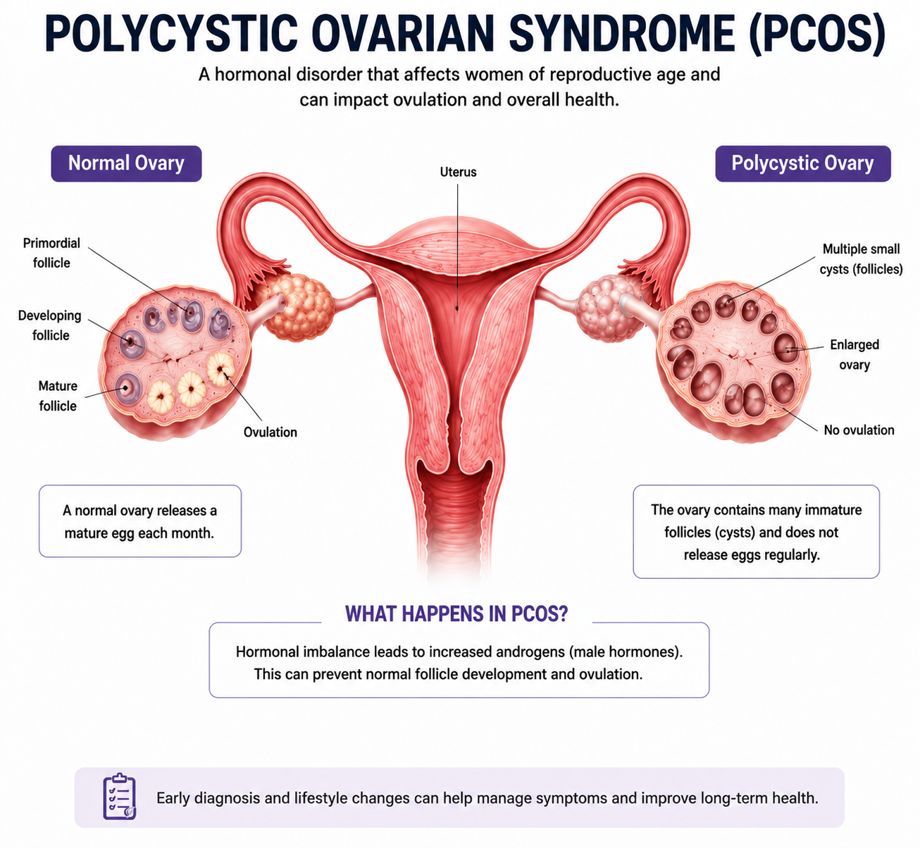 Dr. Dean Martin Polycystic Ovary Syndrome